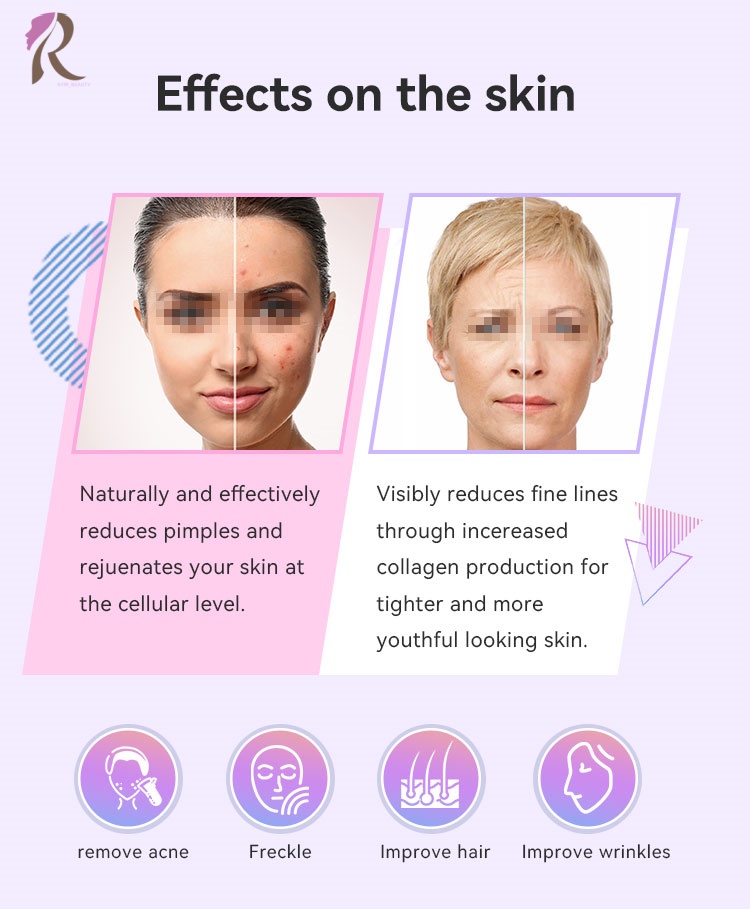 High Frequency Wand 6 in 1 Handheld Facial Machine with LCD Screen for Acne Removal Skin Tightening and Hair Loss Treatment