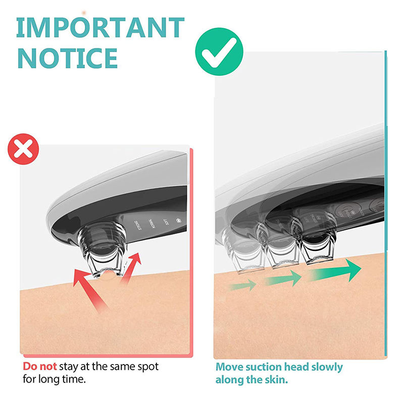 Rechargeable WIFI 300000 HD Camera Plastic Hand Held Electric Blackhead Remover Pore Cleaner Vacuum Skin Care Tool Acne