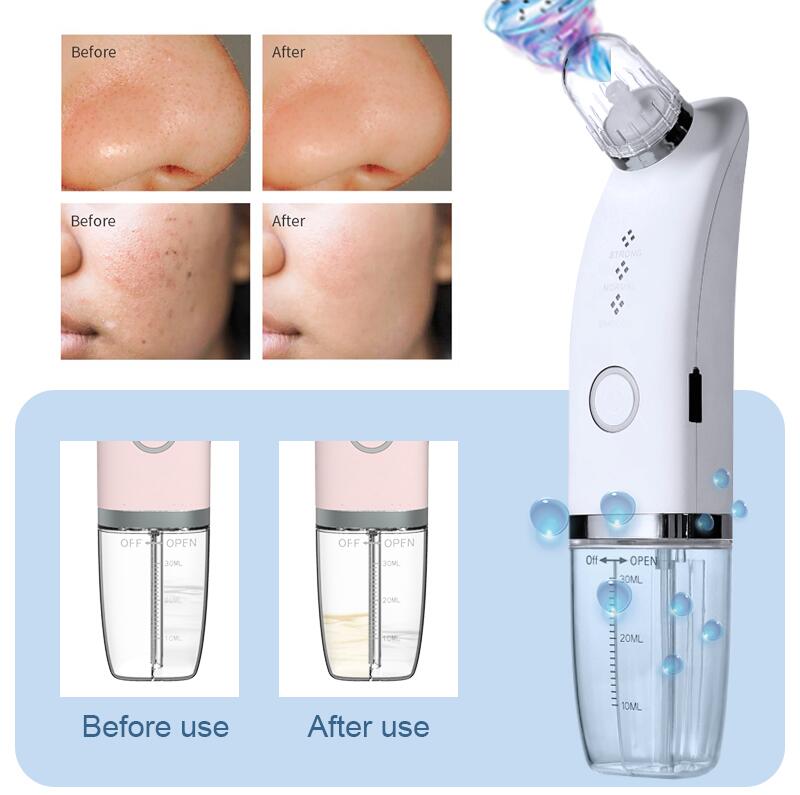 Microdermabrasion Machine Usage Details 1