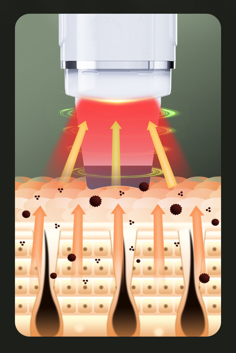 ION+ Positive Ionizing
