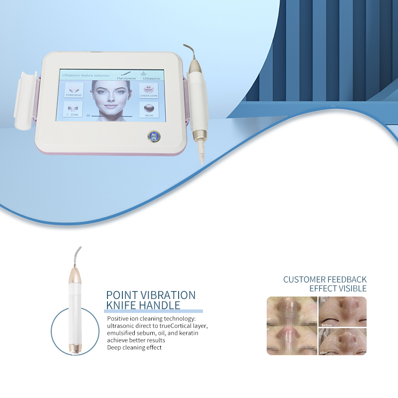 Newly Developed Deep Cleansing Beauty Device Exfoliating Blackhead And Acne Knife Scrubber Targets Clogged Pores On Face Nose