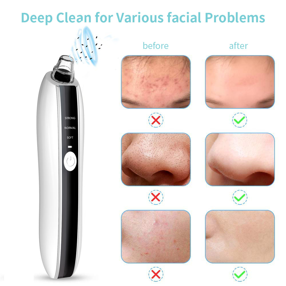 Face Beauty Visible HD Comedone Acne Extractor Electric Painless Facial Nose Skin Pore Cleaner Remover Blackhead Vacuum Suction