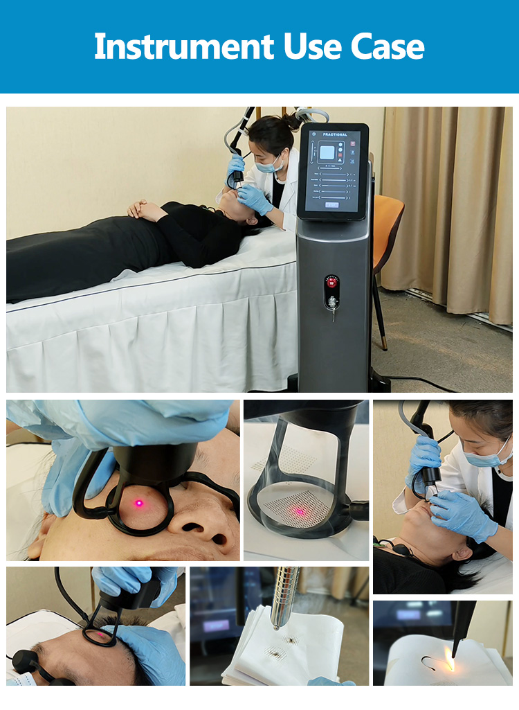 2 In1galss Metal Co2 Laser Cutting Machine Skin Resurfacing Co2 Fractional Laser Machine Vaginal Skin Tightening Machine