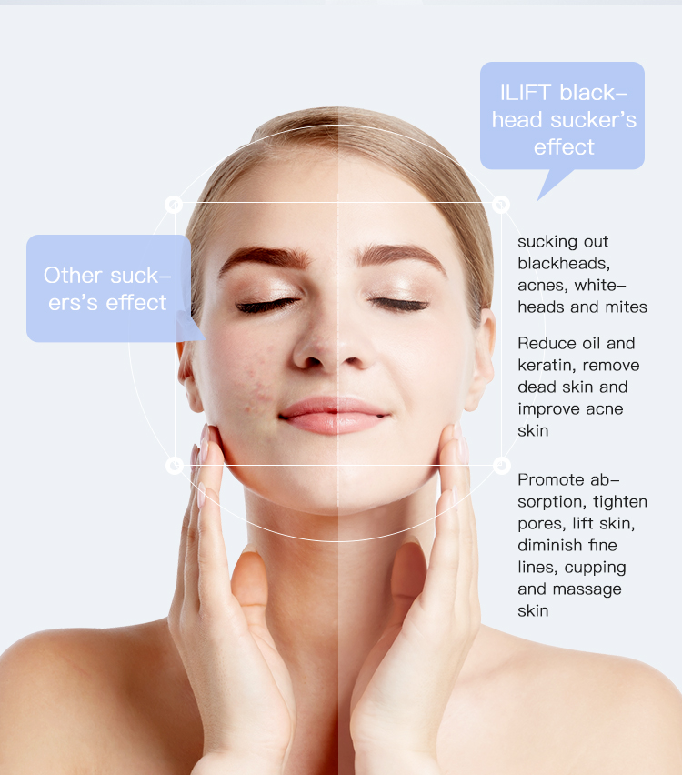 Facial Blackhead Removal Tool Vacuum Device for Acne Treatment Nose Head Application