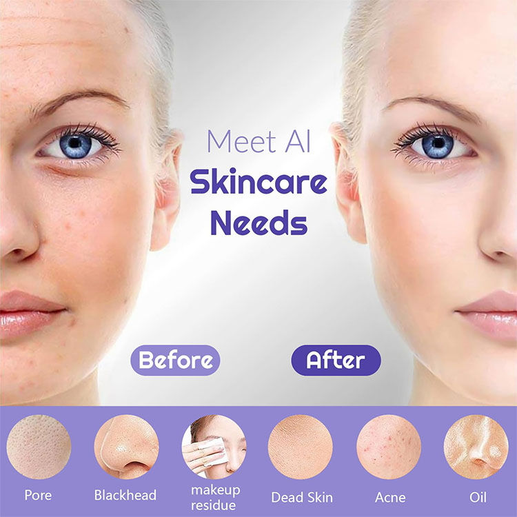 Electric Facial Cleansing Brush Details 5
