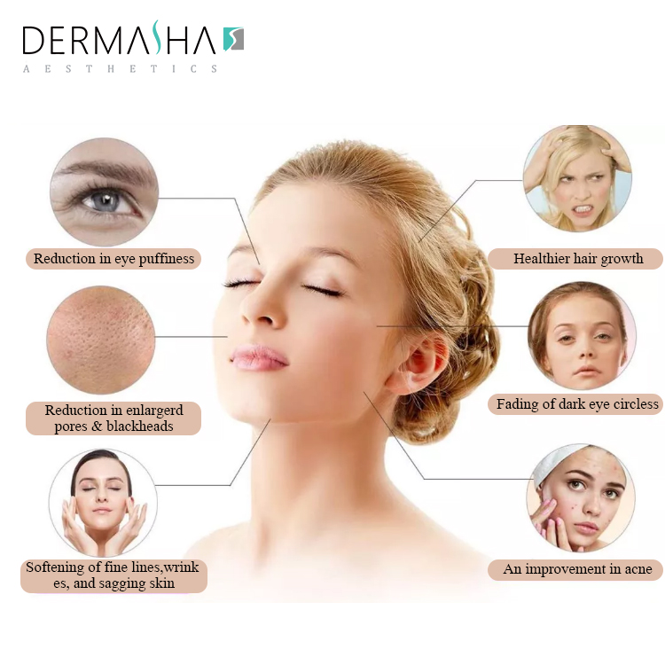 High Frequency Beauty Equipment Skin Acne Scar Removal Wand Portable Facial Skin Care Wrinkle Reducing Electrotherapy Machine