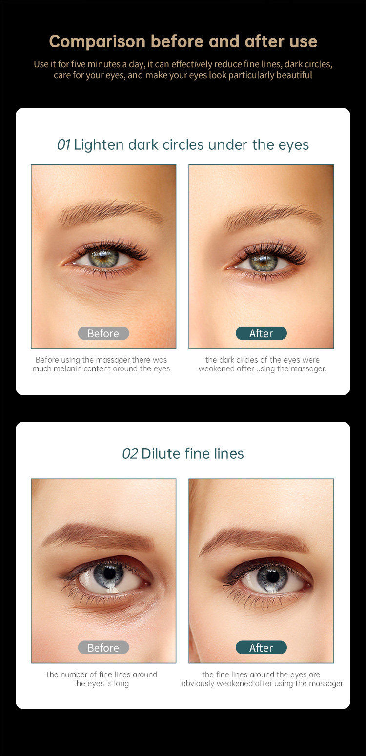 Eye Massager Detail 11