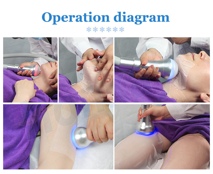Body treatment area belly