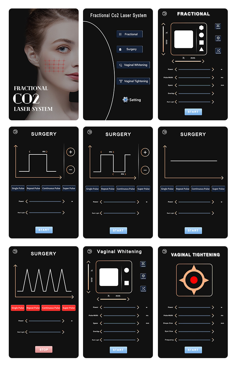 CO2 Fractional Laser Machine Treatment Scans 8