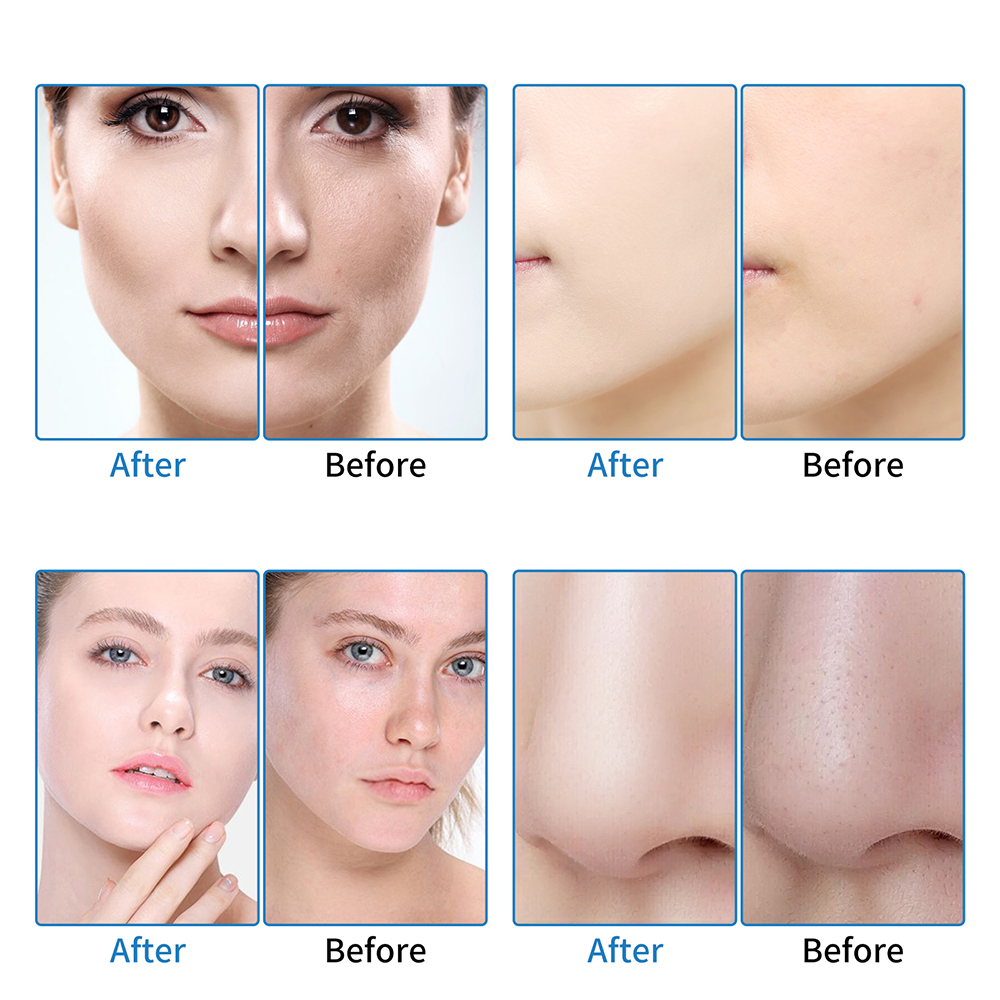 Treatment Results 2