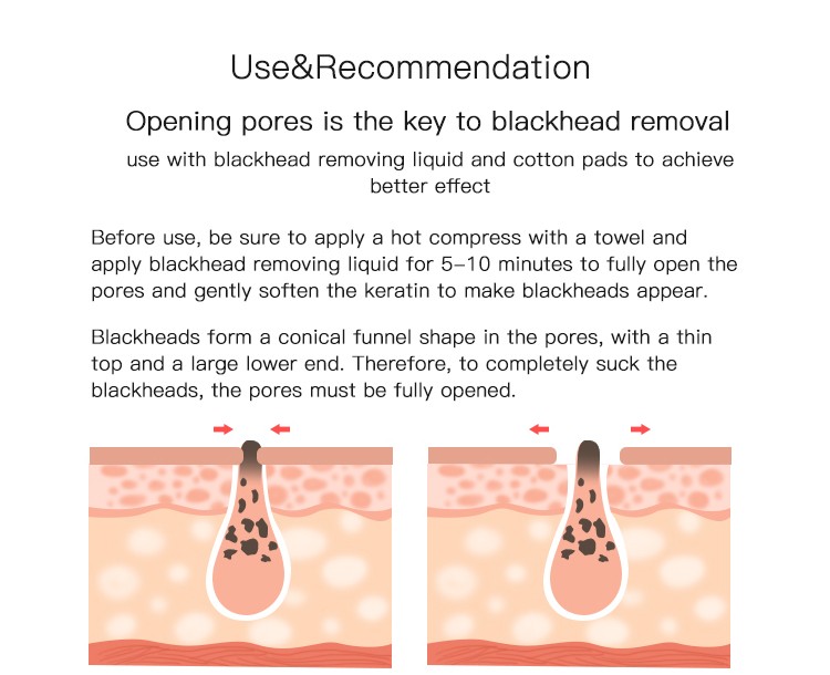 Facial Blackhead Removal Tool Vacuum Device for Acne Treatment Nose Head Application
