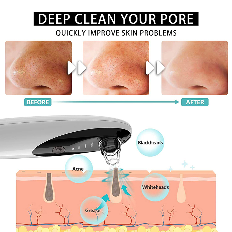 Rechargeable WIFI 300000 HD Camera Plastic Hand Held Electric Blackhead Remover Pore Cleaner Vacuum Skin Care Tool Acne