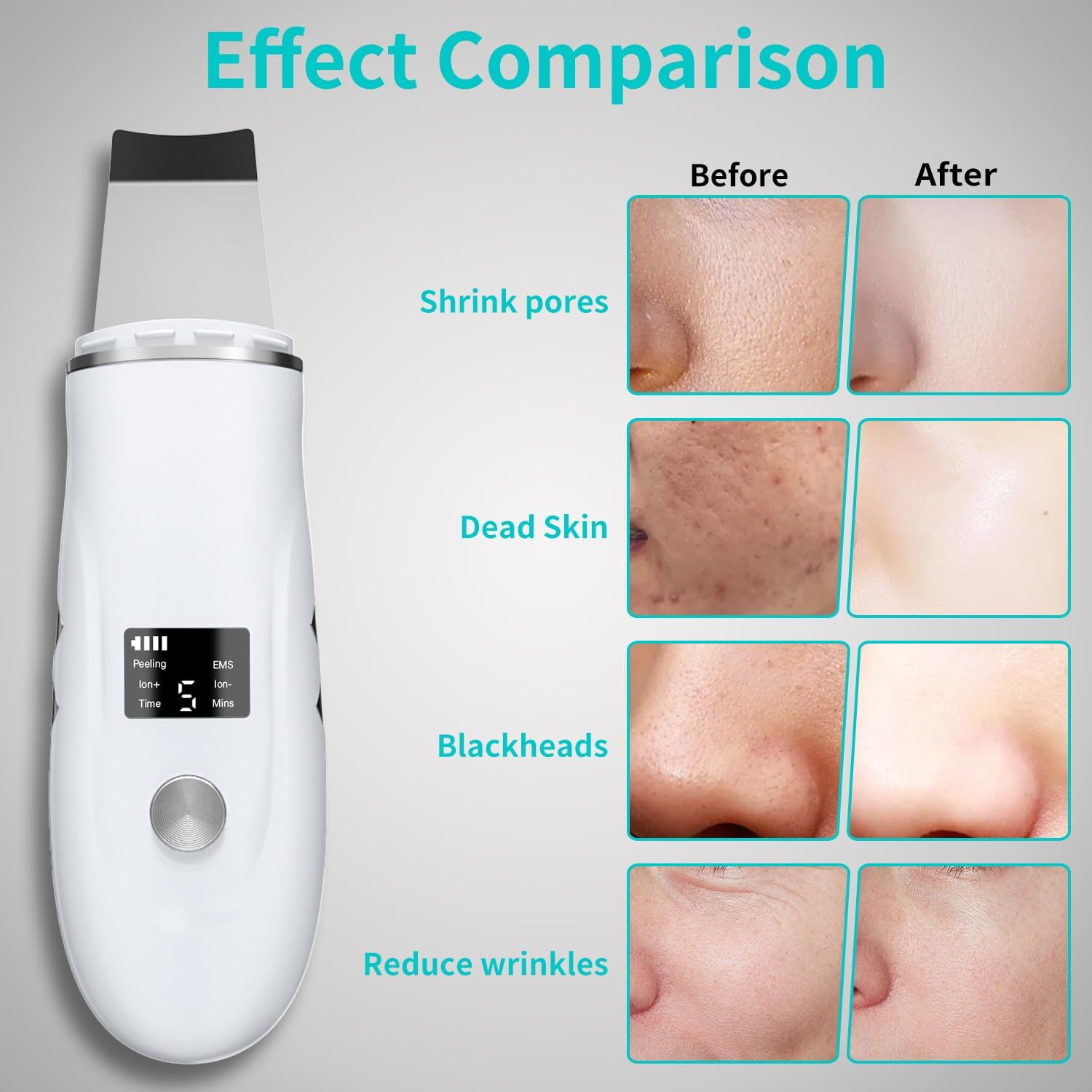 Hot Sale Face Scrubber Facial Peeling Skin Scrubber Deep Facial Cleaning Spatula Acne Pore Ultrasonic Scrubber Facial Cleanser