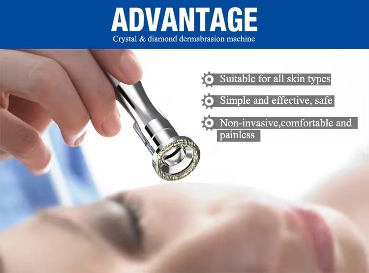 Dermabrasion handles detail
