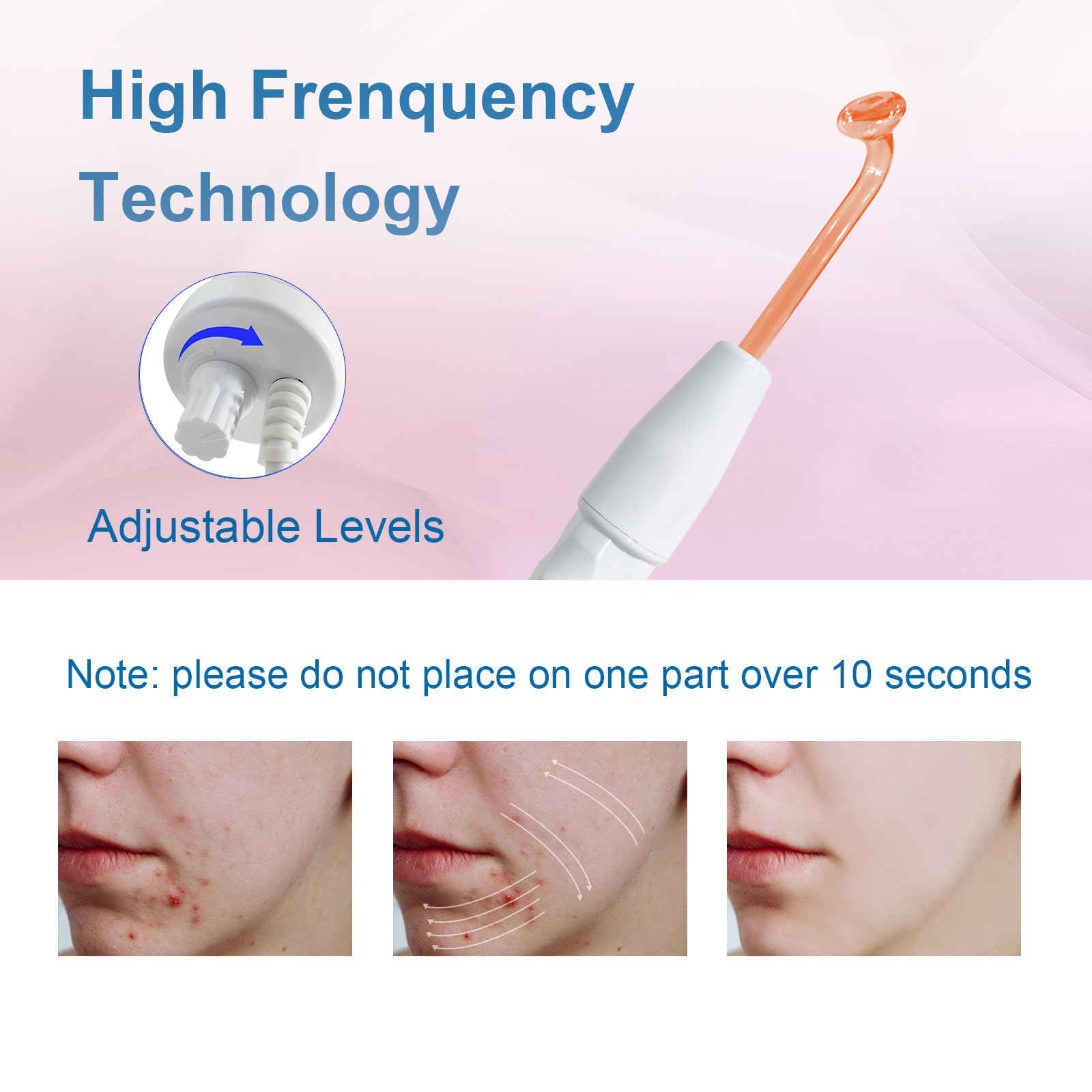 4 in 1 Handheld Acne Treatment Electrode Therapy Ozone Facial Beauty Wand Portable High Frequency Facial Machine