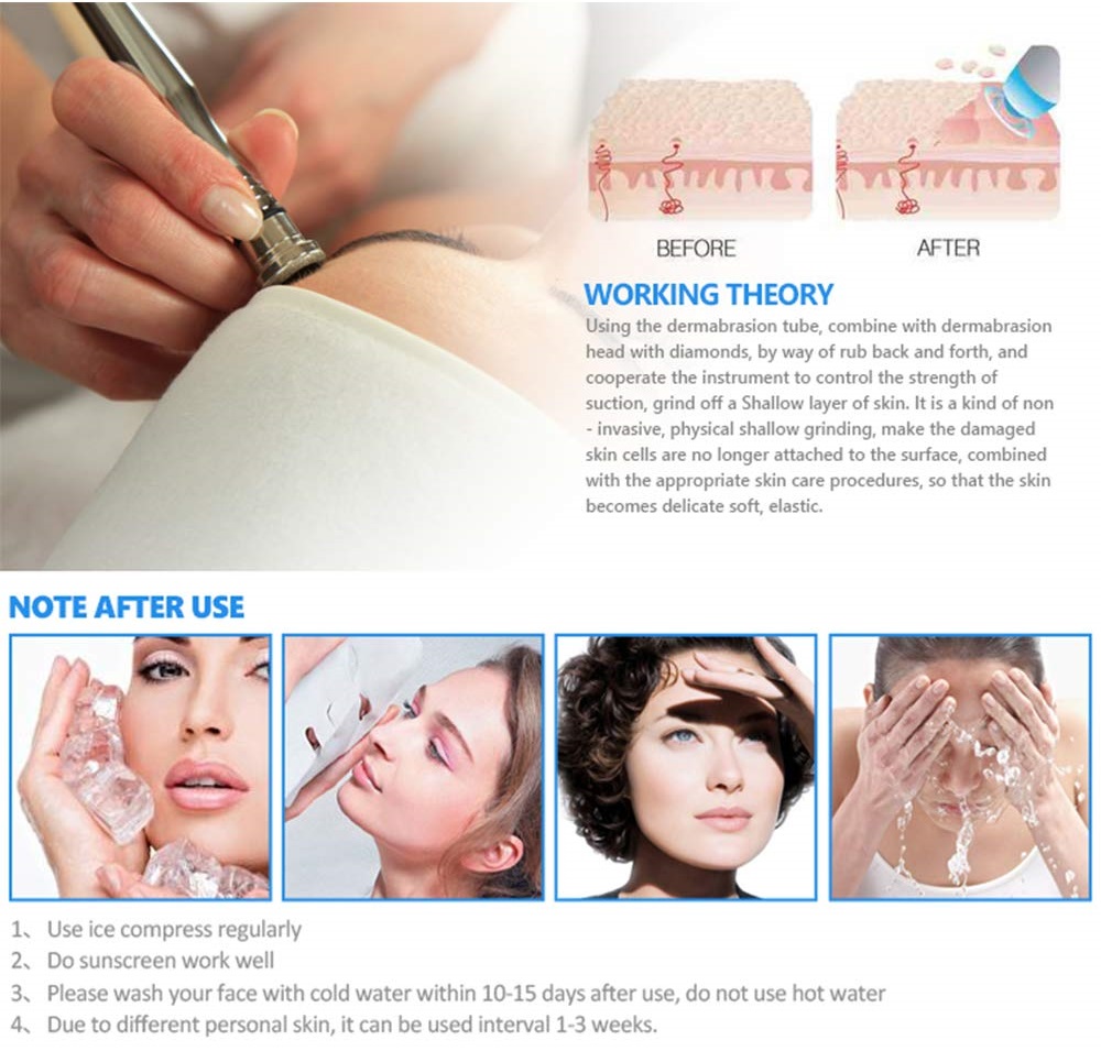 Diamond Dermabrasion Machine 2