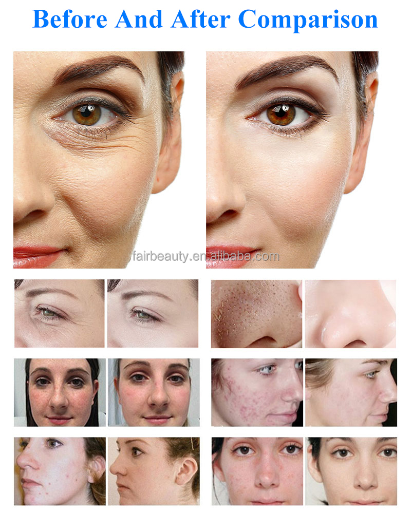 Facial Machine View 7