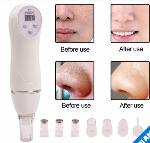 Blackhead Remover Multi-Voltage Vacuum Skin Scrubber with Dermabrasion ABS Material CE Certified for Face Care