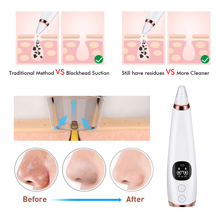 Pore Cleaner Vacuum Details 5