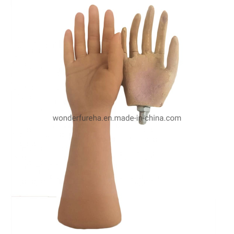 Miembros artificiales prótesis implantes médicos prótesis de mano guante de silicona artificial