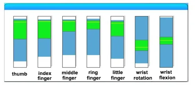 Evaluación de Rehabilitación de Mano