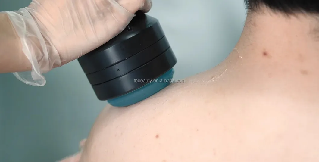 High Effective Focused Shock Wave Device Therapy