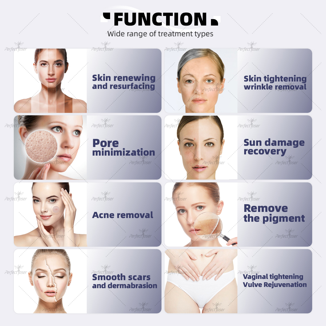 CO2 Fractional Laser Detail 4