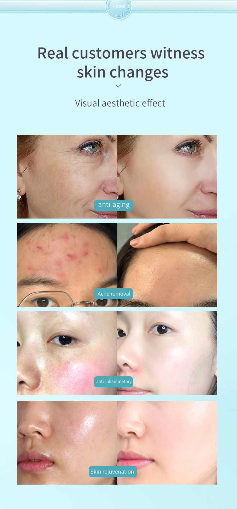 I-COOL Skin System Detail 9