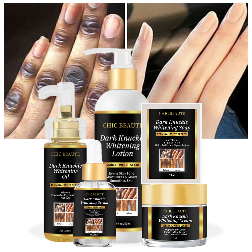 OEM Custom Logo Vitamin C Dark Knuckle Knees Remover Whitening Bleaching Serum Cream Body Lotion Oil Skin Care Set For Skin