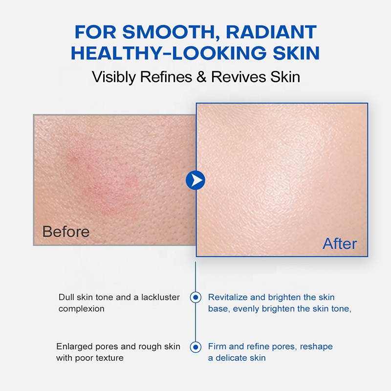 OEM ODM PDRN Serum 30Ml Soothe Redness Soluble Microneedle Bio-Microneedles Anti Aging Serum for Wrinkles Pores and Radiant Skin