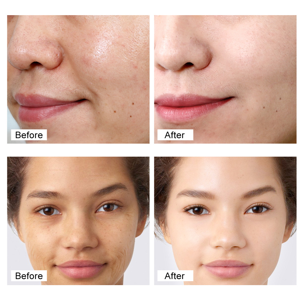 High Quality Freckle Cream Anti Wrinkle Dark Spot Strong Bleaching Whitening Collagen Retinol Vitamin C Face Cream