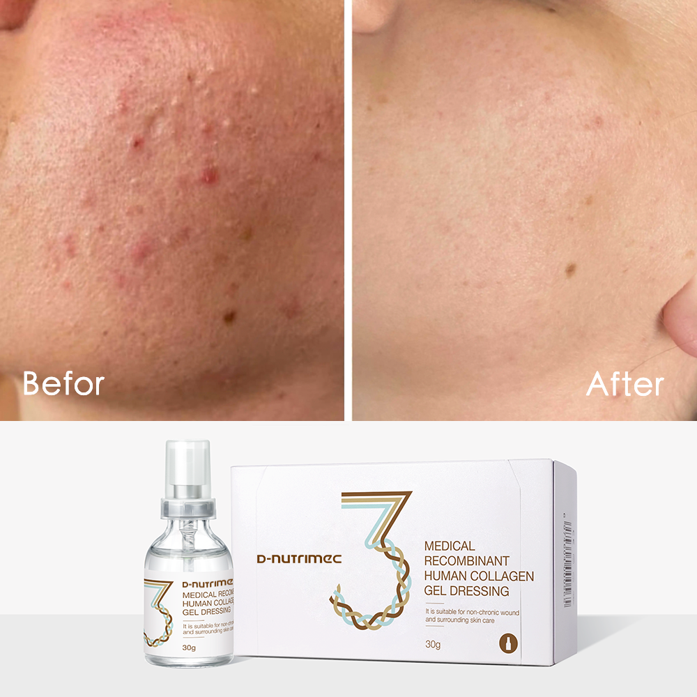 Post-operative Recovery Products Redness Relief Medical-grade Recombinant Collagen Repair Gel Serum For Aesthetic Center