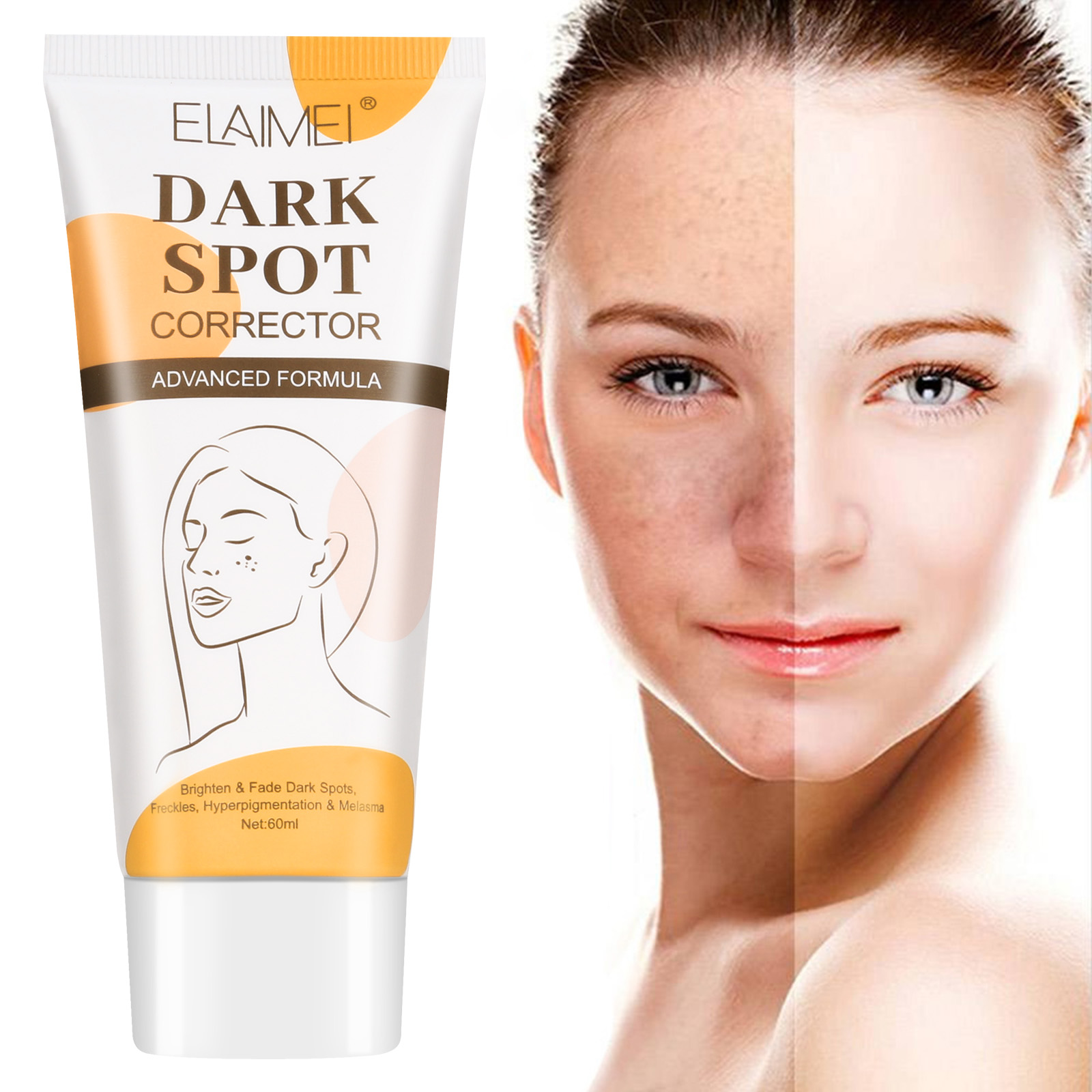 ELAIMEI Hot Sale Pimples and Fade Dark Spot Remover Cream Niacinamide Whitening Face Cream for Women Men Dark Spots