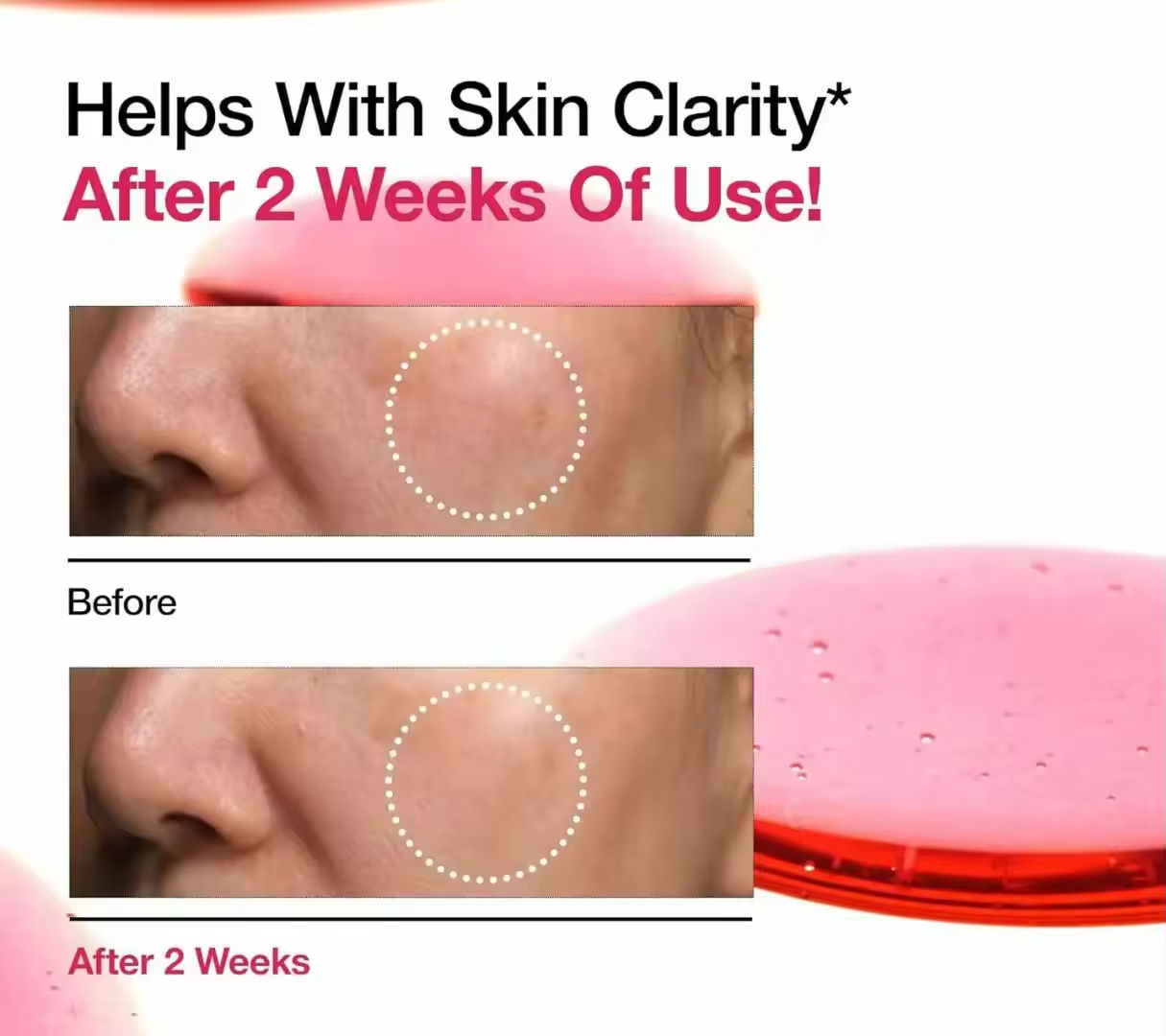 Au Spot Correction Liquid with 10% Niacinamide Azelaic Acid &amp; Glycerin for Face Whitening Moisturizing &amp; Anti-Aging 30ml