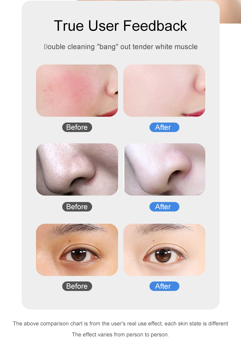 Skin Care Device Gallery 4