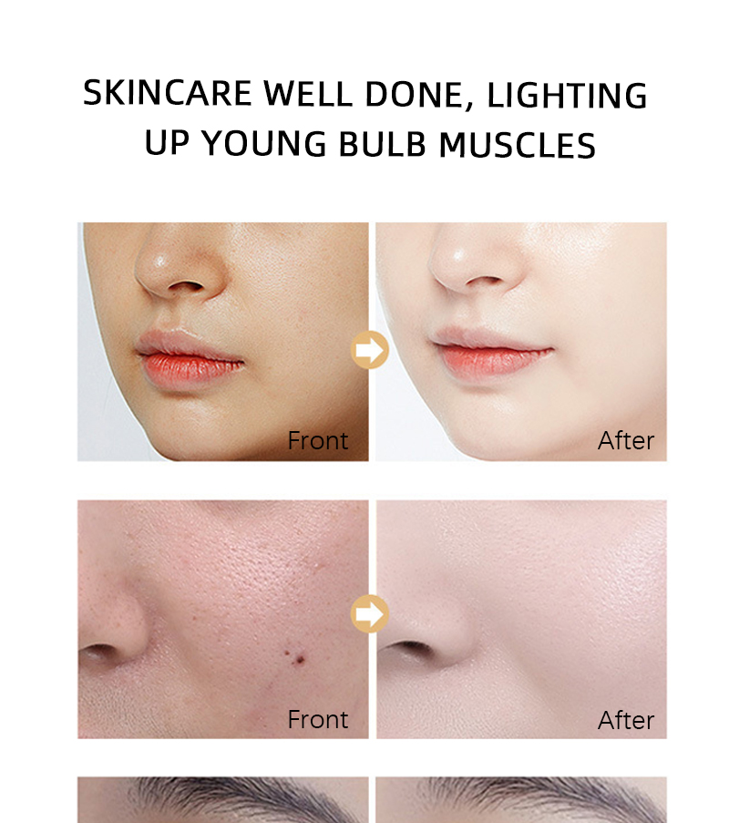 Private Label Anti Aging Serum Face Skin Care Nicotinamide Whitening Wrinkle Acne Dark Spot Remover Face Care Serum