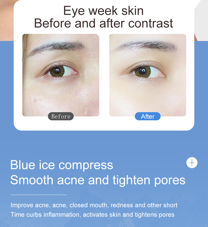 Skin Care Device Gallery 10