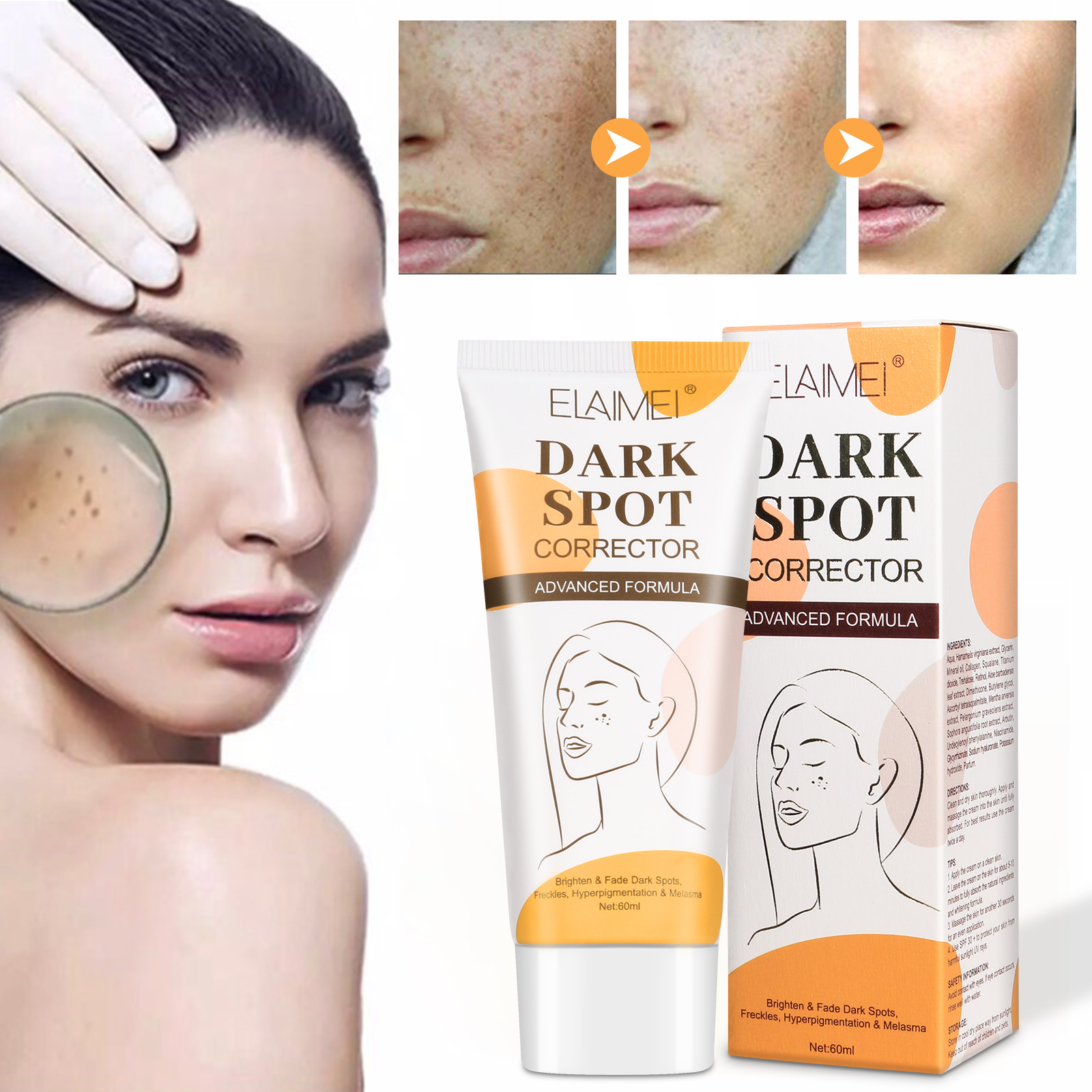 ELAIMEI Hot Sale Pimples and Fade Dark Spot Remover Cream Niacinamide Whitening Face Cream for Women Men Dark Spots