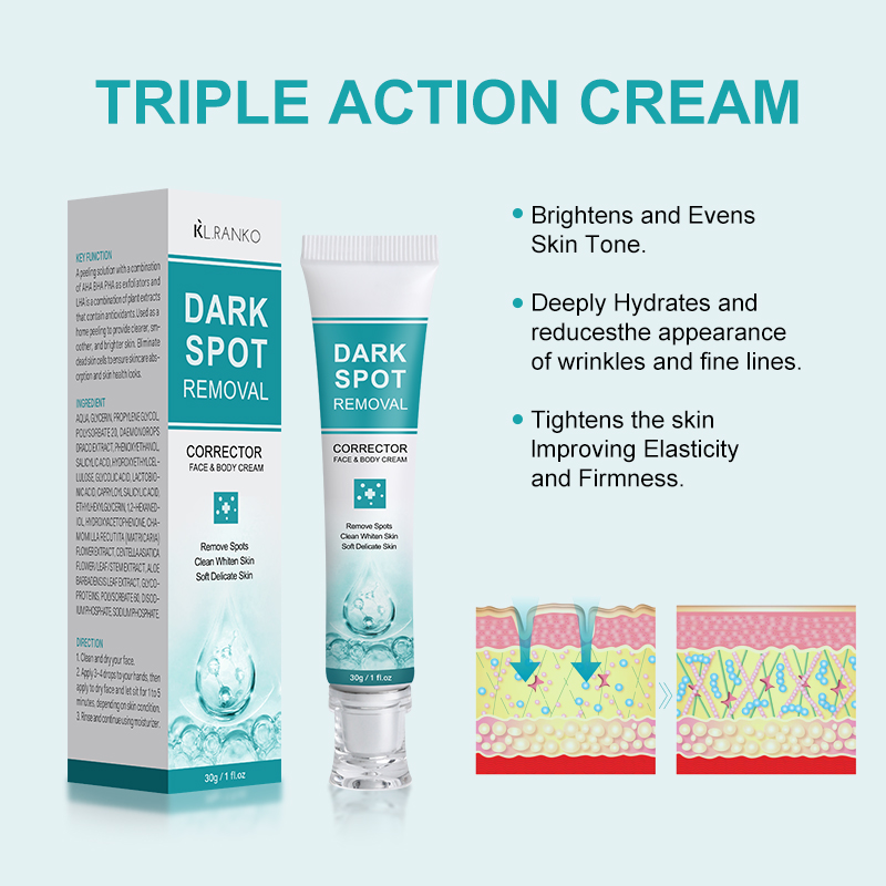 Wholesale Dark Spot Removal Cream to Remove Dark Spots Freckles Melasma Acne Blot Whitening Skin Care Products