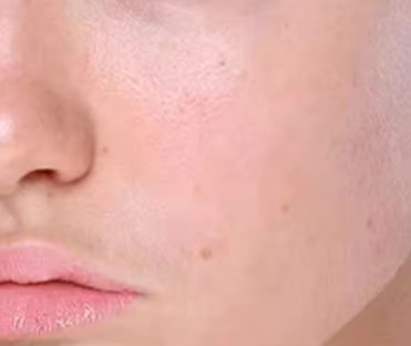 Before Use