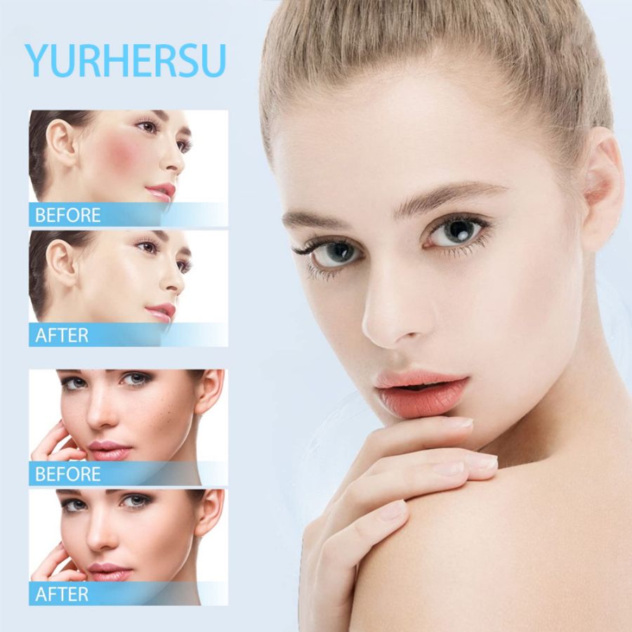Wholesale Private Label Freckles Melasma Remover Serum Hydrating Niacinamide Salicylic Acid Serum Dark Spot Remover Face Serum