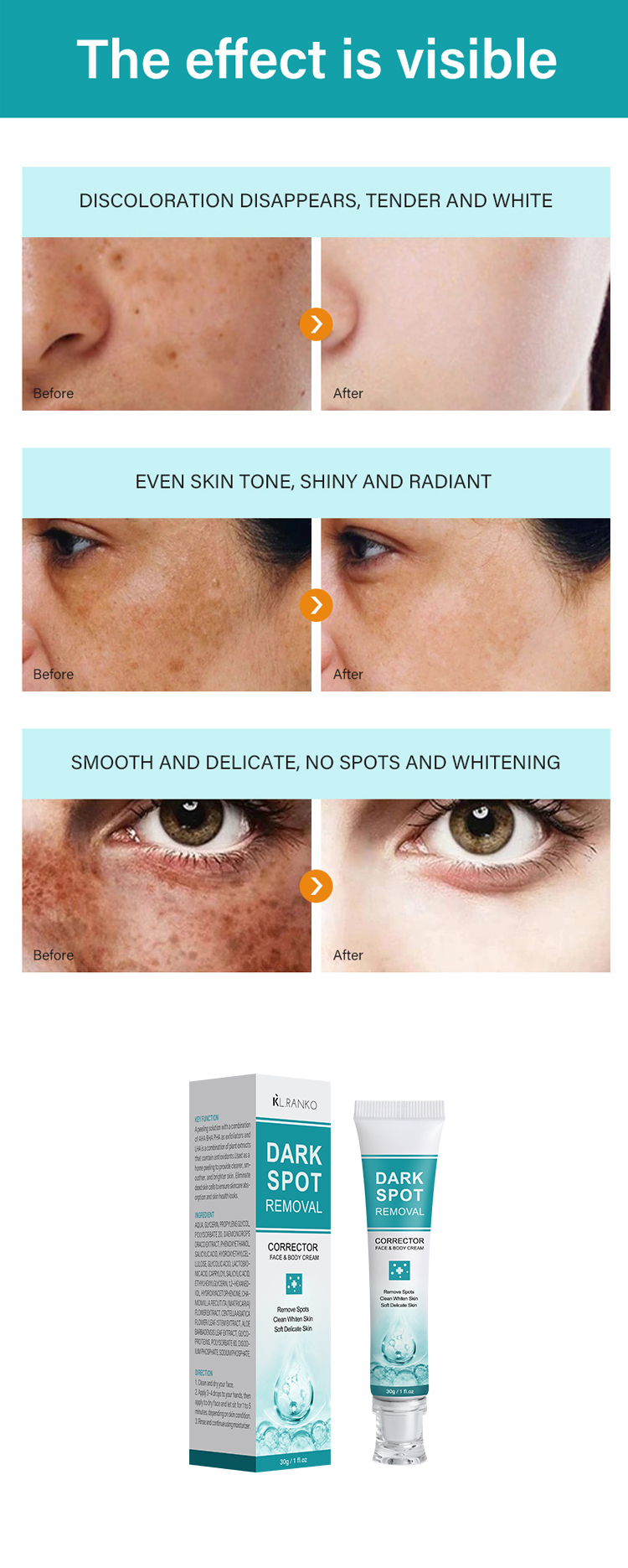 Dark Spot Removal Cream details 6