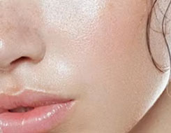 Dry Skin