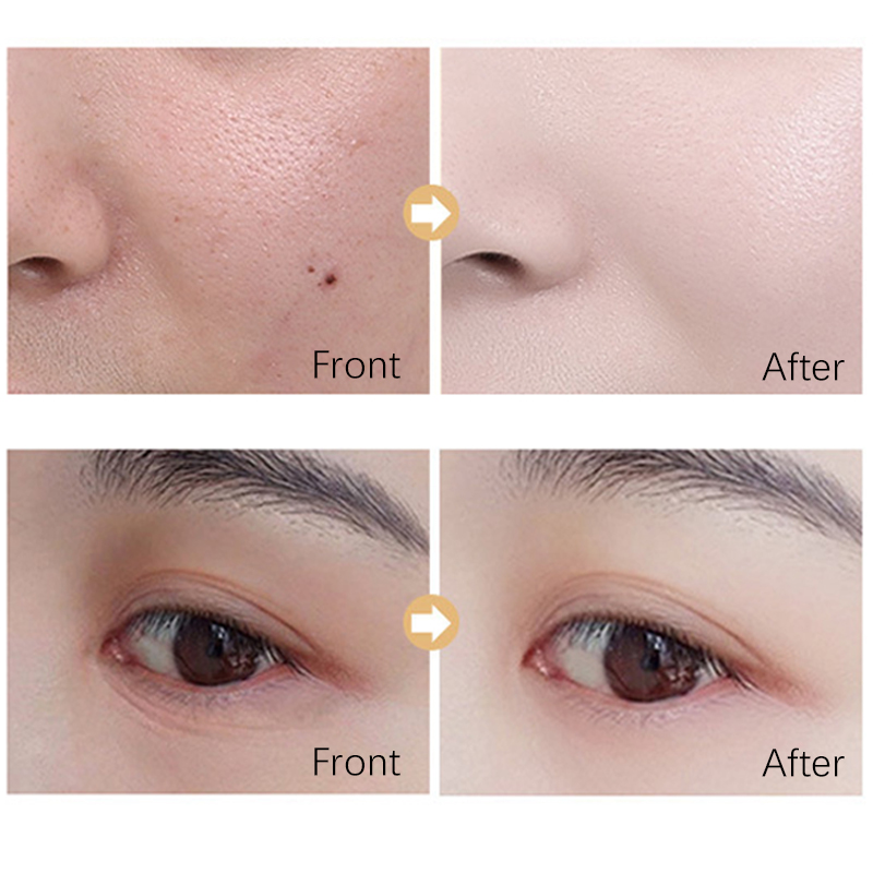 Private Label Anti Aging Serum Face Skin Care Nicotinamide Whitening Wrinkle Acne Dark Spot Remover Face Care Serum