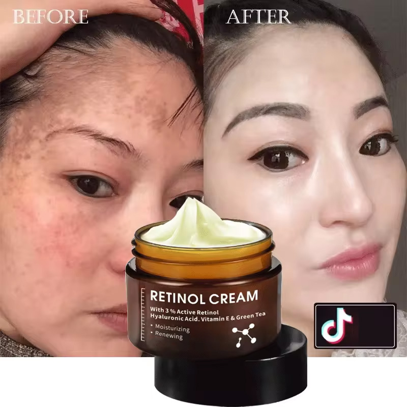 High Quality Freckle Cream Anti Wrinkle Dark Spot Strong Bleaching Whitening Collagen Retinol Vitamin C Face Cream