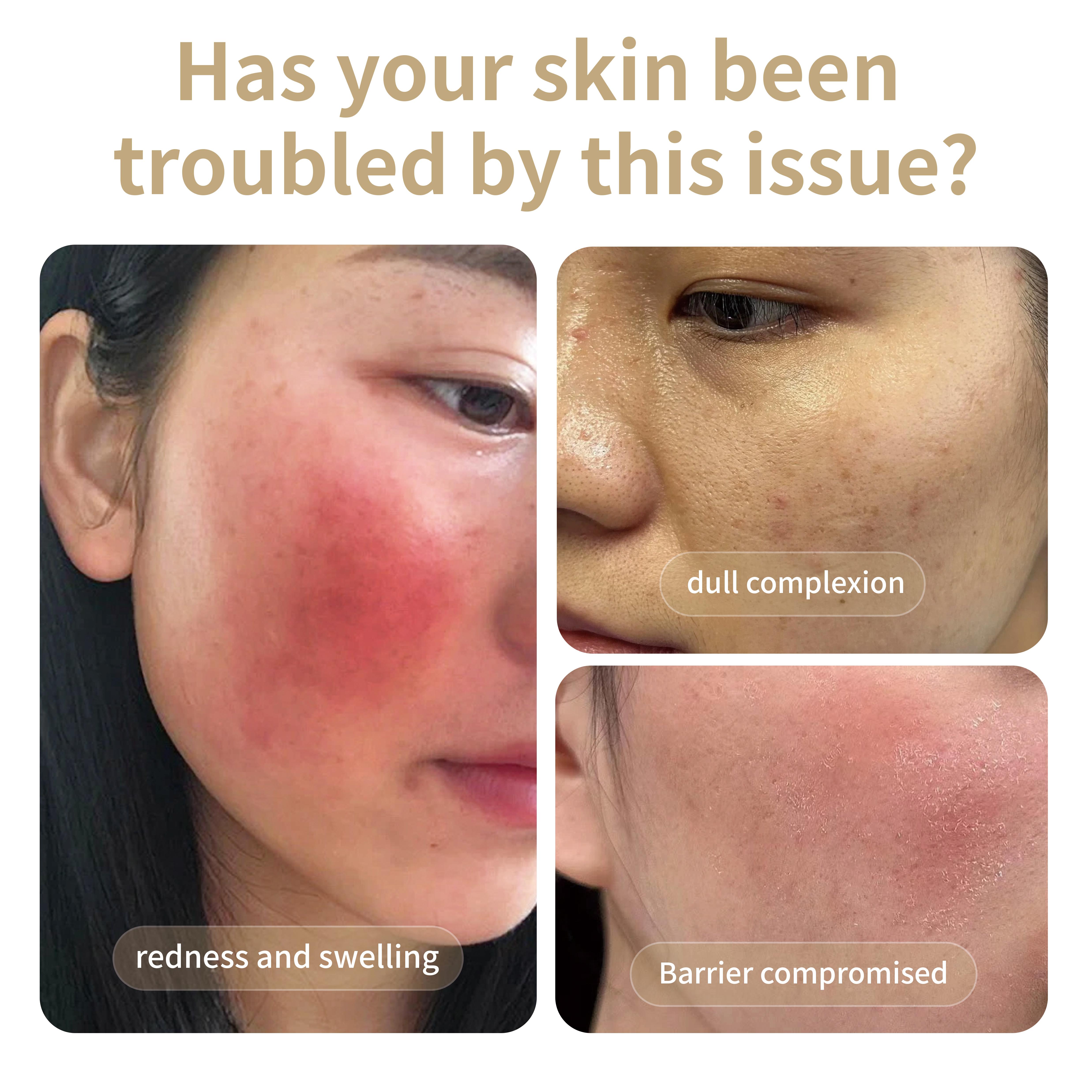Advanced Hydra Repair Ampoule for Skin Barrier Recovery &amp; Redness Relief,Intensive Soothing Serum,Professional Derm-Clinic Grade