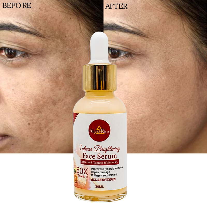 Private Label Vitamin C Korean Skin Whitening and Dark Spot Removal Arbutin Tomato Skin Care Serum for Women