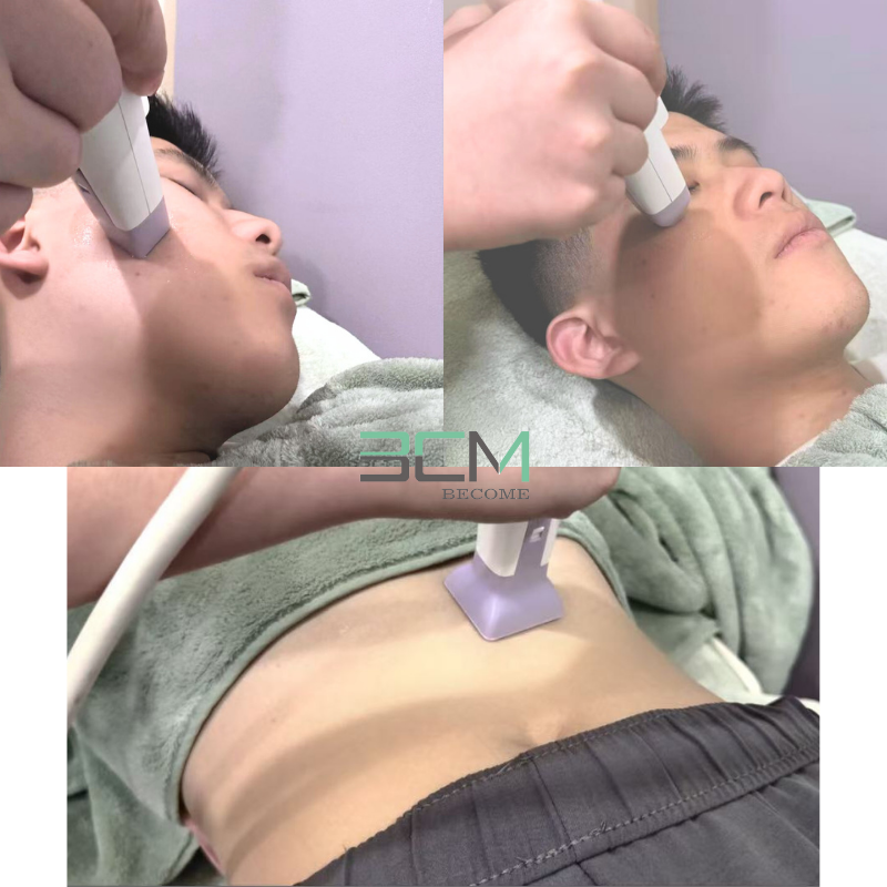 Professional Thermal Micropin Device for Skin Tightening Face Lifting Acne &amp; Wrinkle Reduction Machine