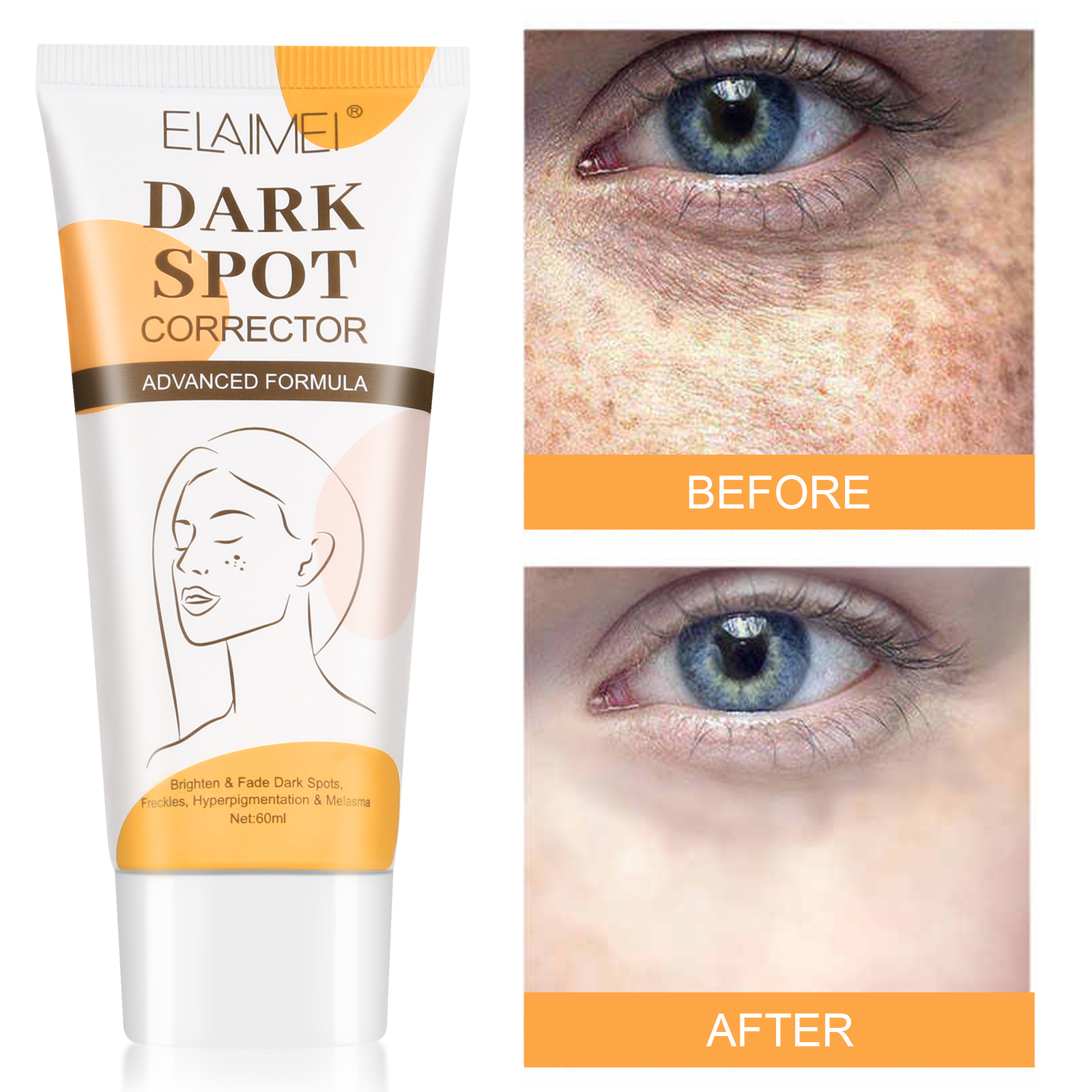 ELAIMEI Hot Sale Pimples and Fade Dark Spot Remover Cream Niacinamide Whitening Face Cream for Women Men Dark Spots