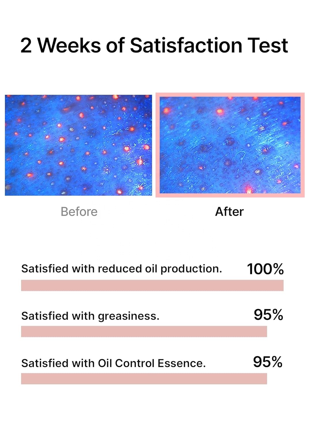 celimax Tea Tree Sebum Reducing Serum Mattifyin Hydrating Moisturizing Mild Formula Sensitive Care Oil Control Capsule Essence